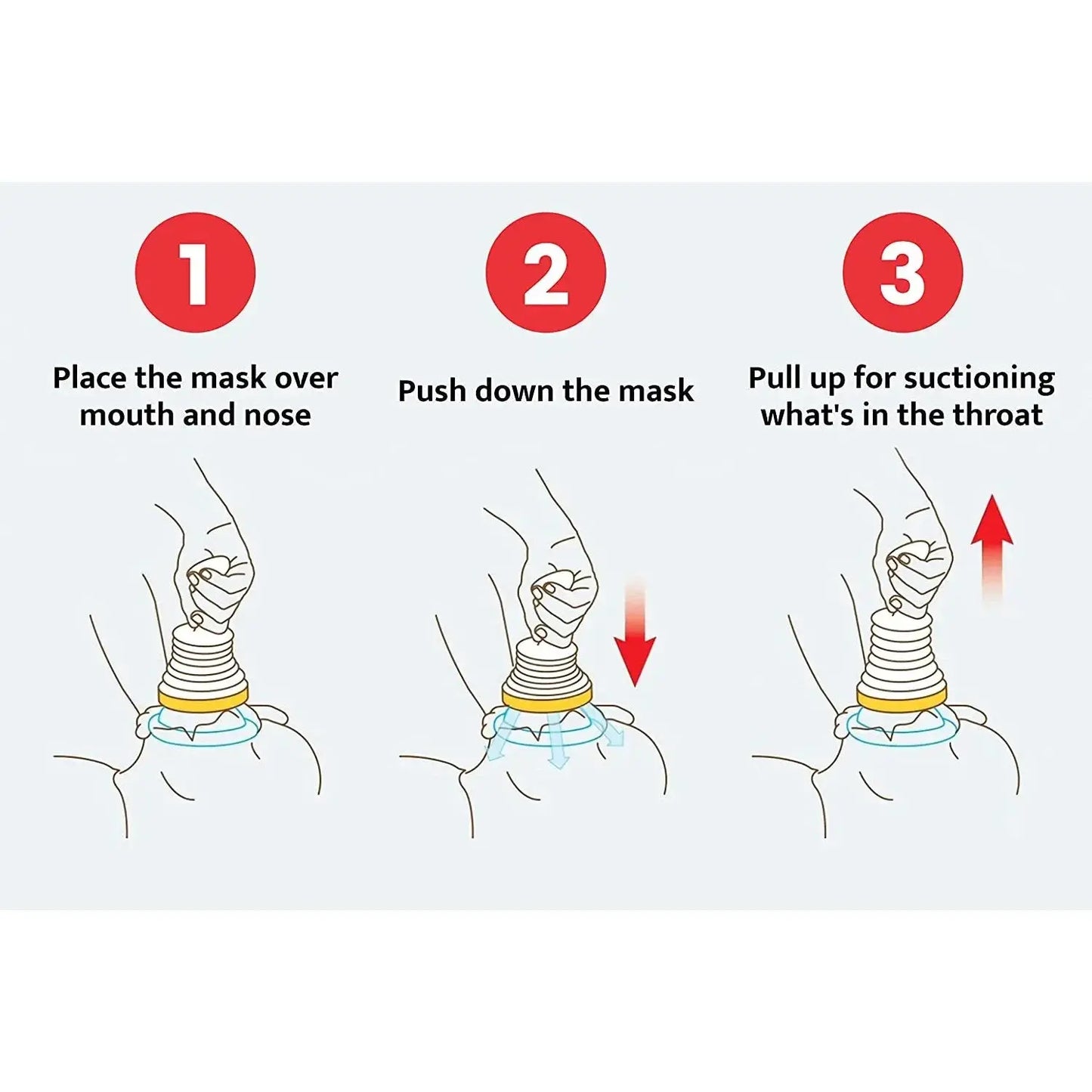 First Aid Kit Choking Device Adults & Children Home Asphyxia Rescue Device Anti Suffocation 2 Size Choking Rescue Kit 4PCS/Set NNOS