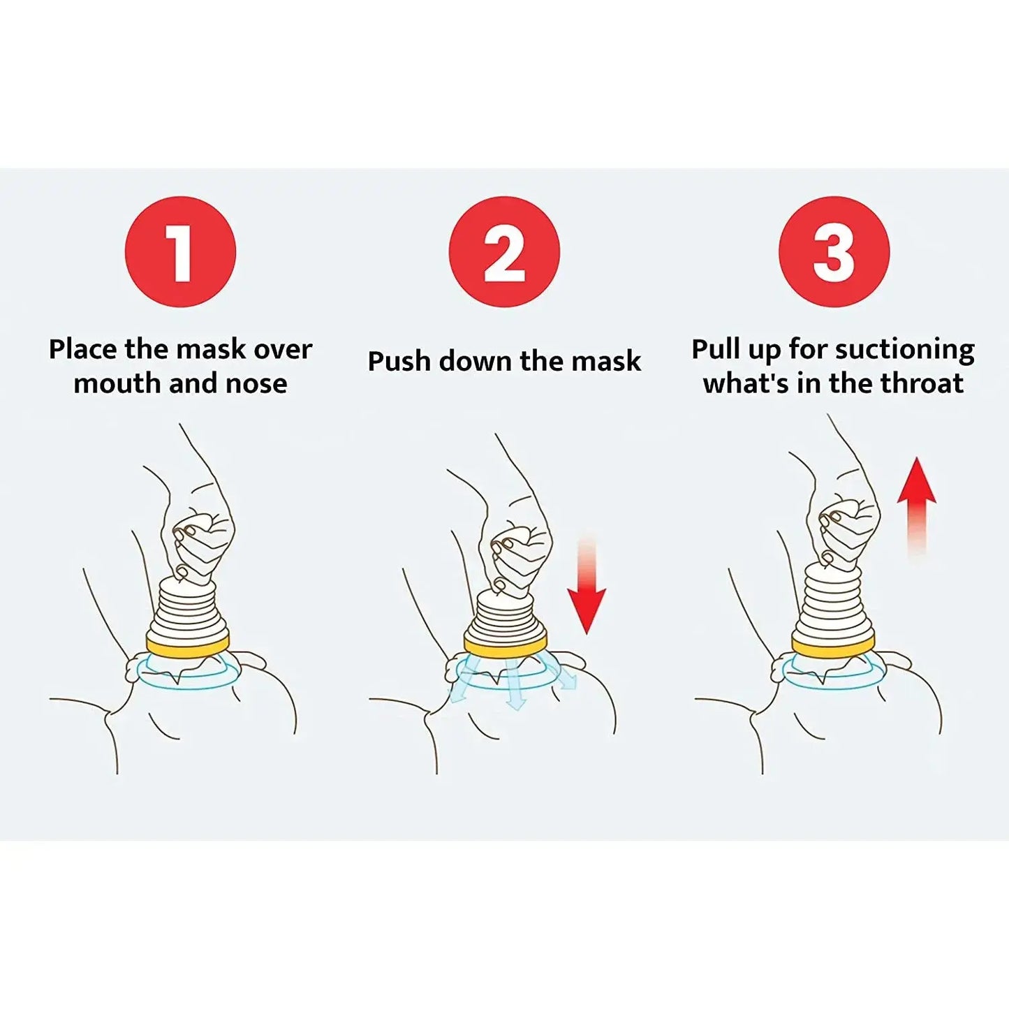 First Aid Kit Choking Device Adults & Children Home Asphyxia Rescue Device Anti Suffocaation 2 Size Choking Rescue Kit 4PCS/Set NNOS