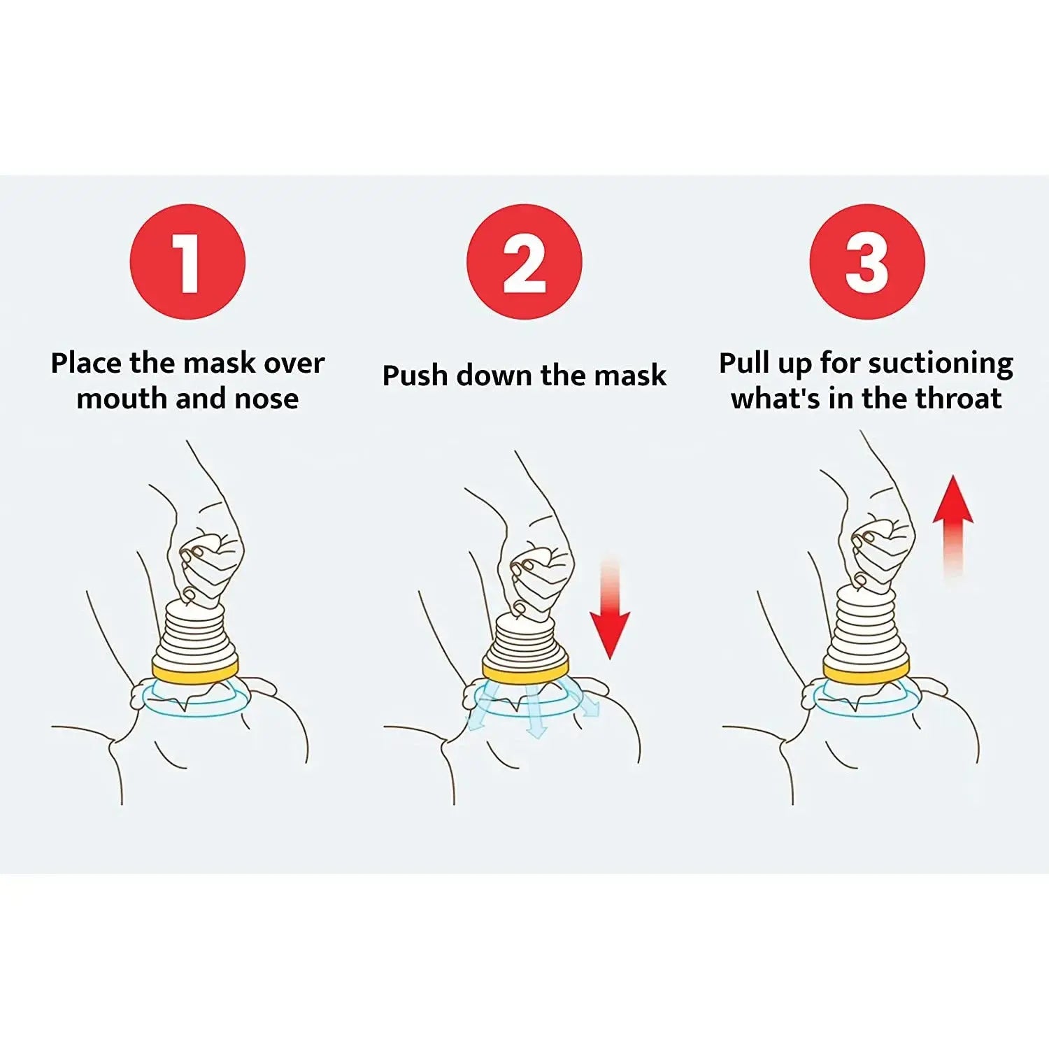 First Aid Kit Choking Device Adults & Children Home Asphyxia Rescue Device Anti Suffocaation  2 Size Choking Rescue Kit 4PCS/Set NNOS